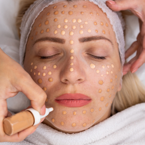 BB Glow vs. Microneedling: Which Skin Treatment is Right for You?
